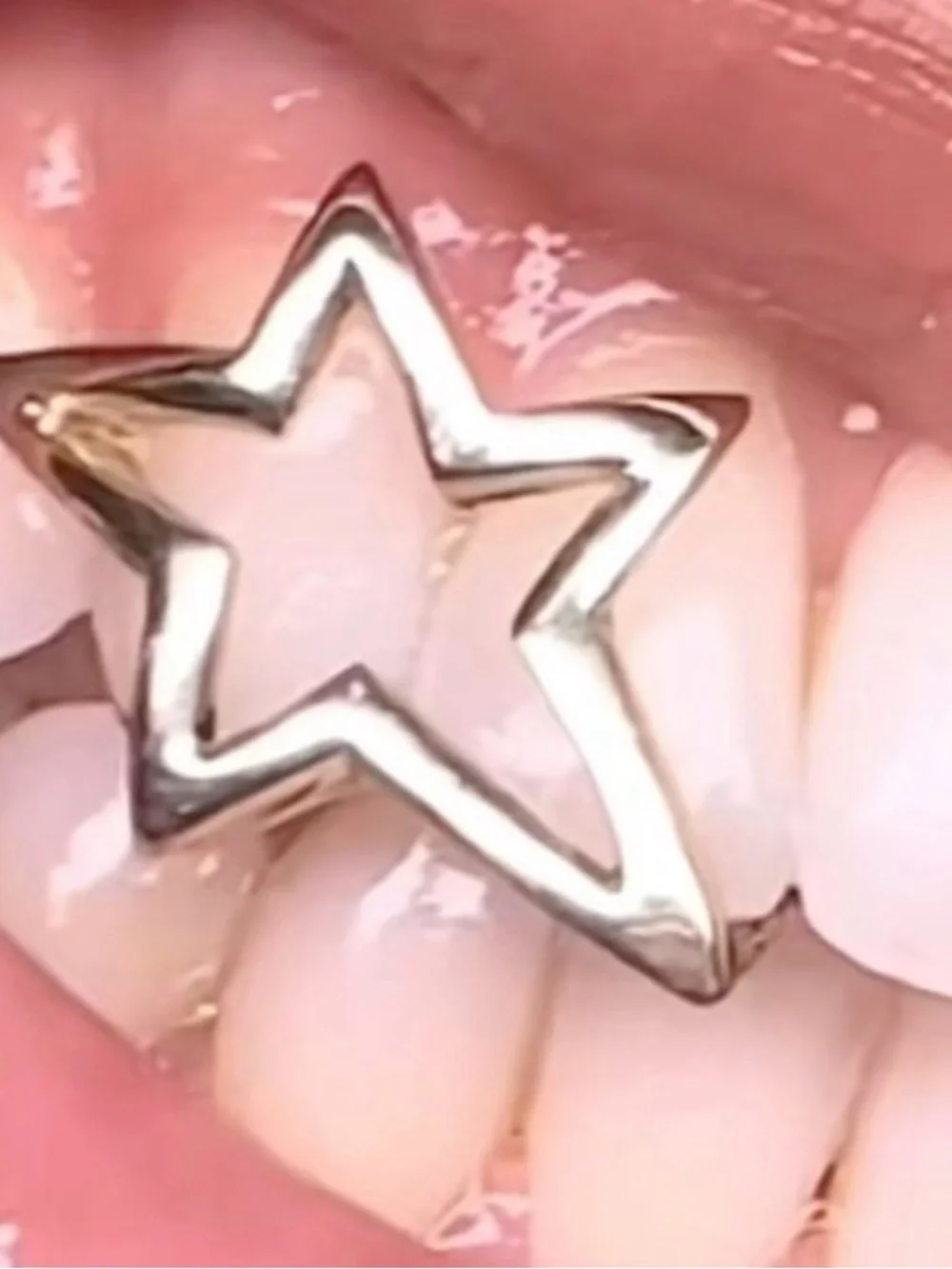 Custom Grillz Mold Kit – Start Your Custom Grillz Order – $150 Deposit